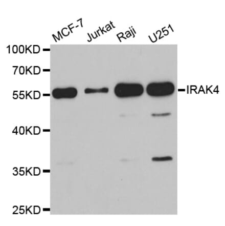 Western blot - IRAK4 antibody from Signalway Antibody (38750) - Antibodies.com