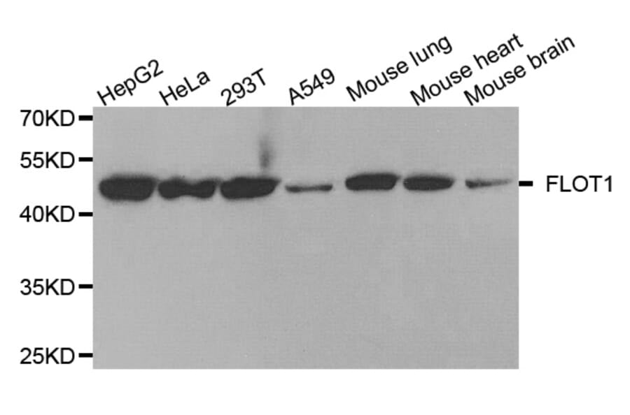 Western blot - FLOT1 antibody from Signalway Antibody (38756) - Antibodies.com