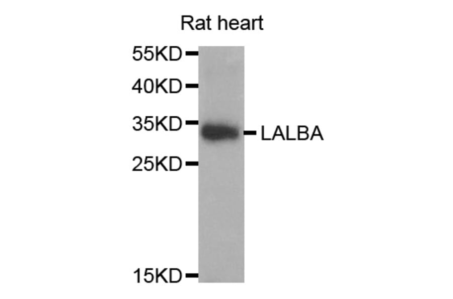 Western blot - LALBA antibody from Signalway Antibody (38764) - Antibodies.com
