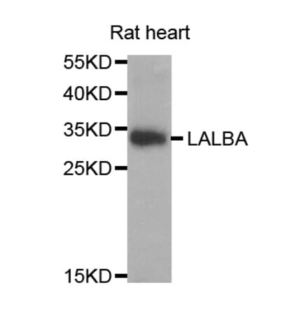 Western blot - LALBA antibody from Signalway Antibody (38764) - Antibodies.com