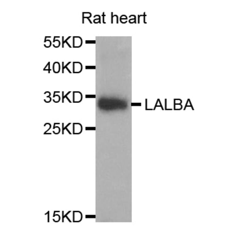 Western blot - LALBA antibody from Signalway Antibody (38764) - Antibodies.com