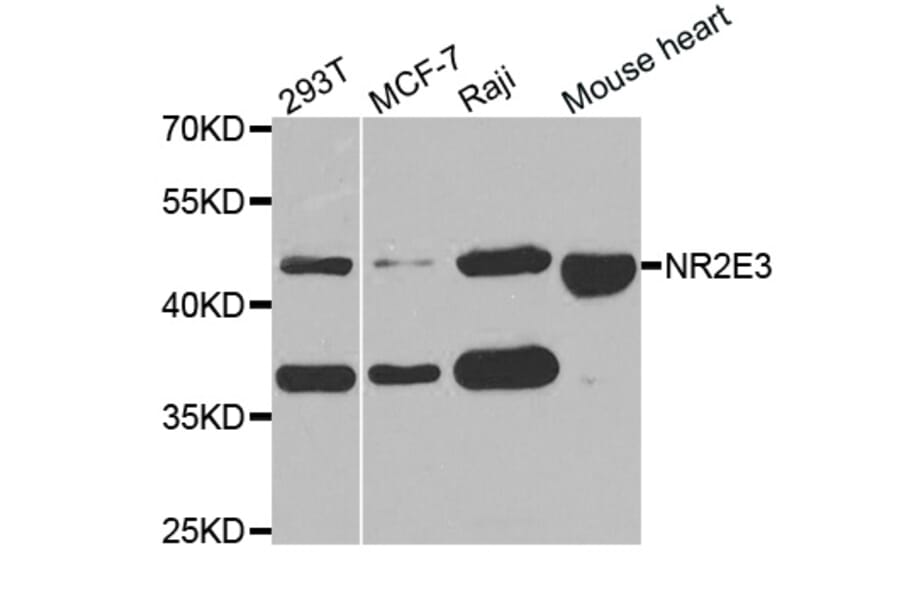 Western blot - NR2E3 antibody from Signalway Antibody (38765) - Antibodies.com