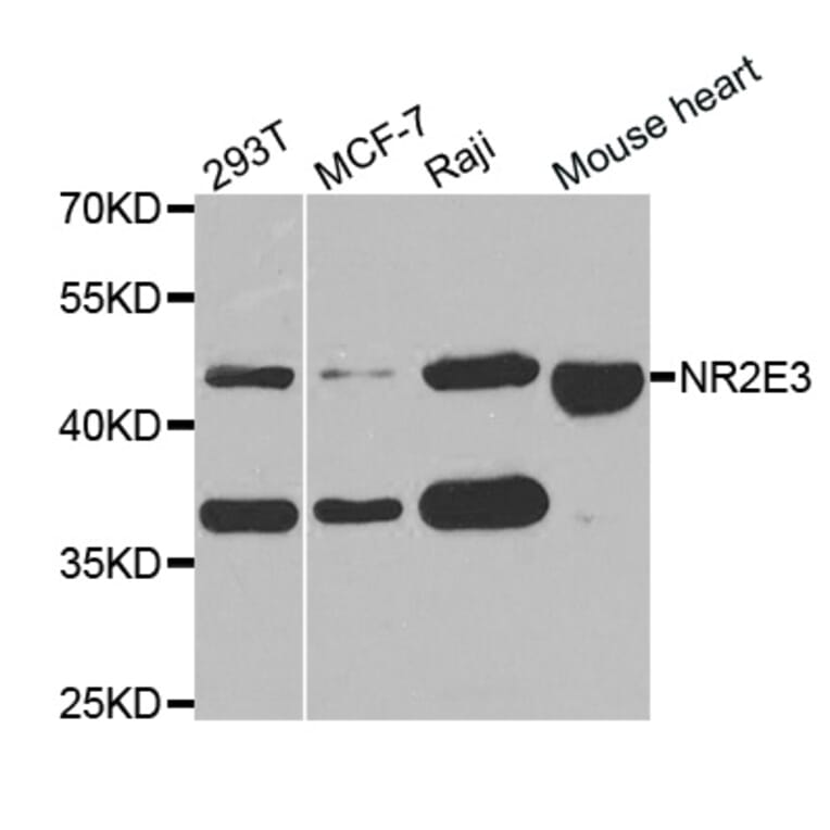 Western blot - NR2E3 antibody from Signalway Antibody (38765) - Antibodies.com