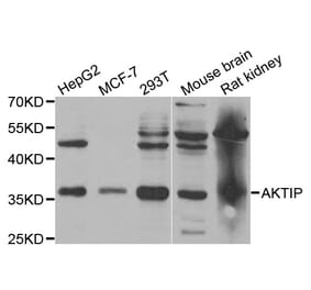 Western blot - AKTIP antibody from Signalway Antibody (38769) - Antibodies.com