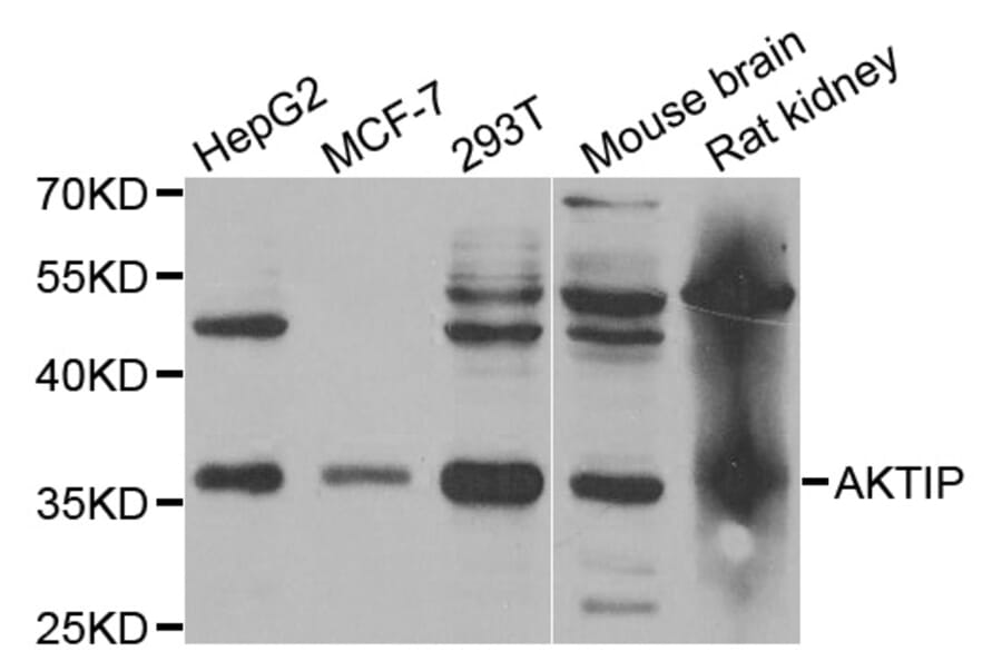 Western blot - AKTIP antibody from Signalway Antibody (38769) - Antibodies.com