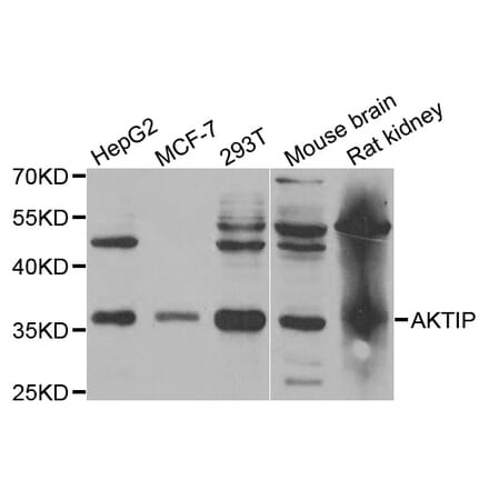 Western blot - AKTIP antibody from Signalway Antibody (38769) - Antibodies.com