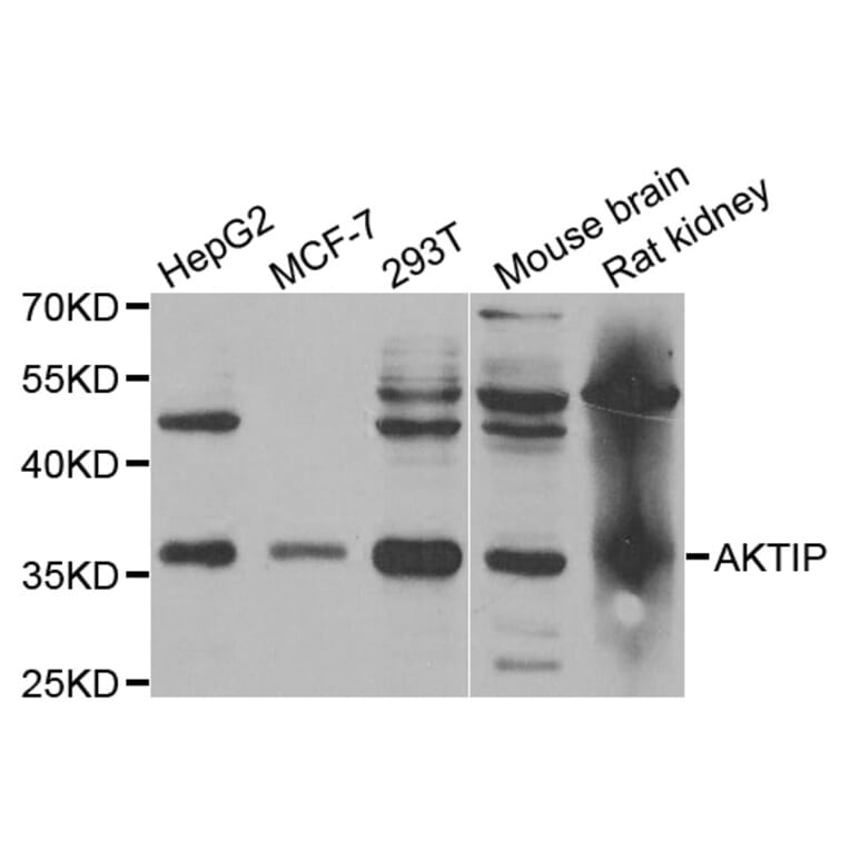 Western blot - AKTIP antibody from Signalway Antibody (38769) - Antibodies.com