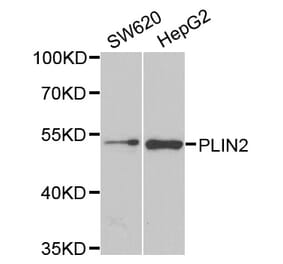 Western blot - PLIN2 antibody from Signalway Antibody (38786) - Antibodies.com