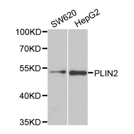 Western blot - PLIN2 antibody from Signalway Antibody (38786) - Antibodies.com