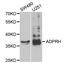 Western blot - ADPRH antibody from Signalway Antibody (38787) - Antibodies.com