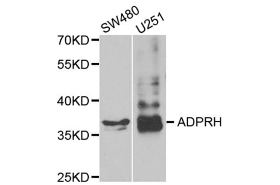 Western blot - ADPRH antibody from Signalway Antibody (38787) - Antibodies.com