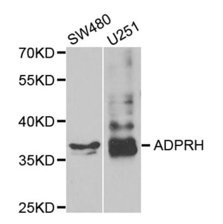 Western blot - ADPRH antibody from Signalway Antibody (38787) - Antibodies.com