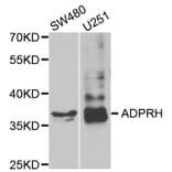 Western blot - ADPRH antibody from Signalway Antibody (38787) - Antibodies.com