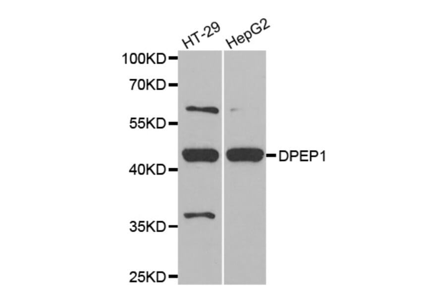 Western blot - DPEP1 antibody from Signalway Antibody (38797) - Antibodies.com