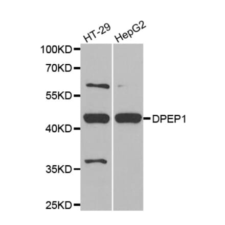 Western blot - DPEP1 antibody from Signalway Antibody (38797) - Antibodies.com