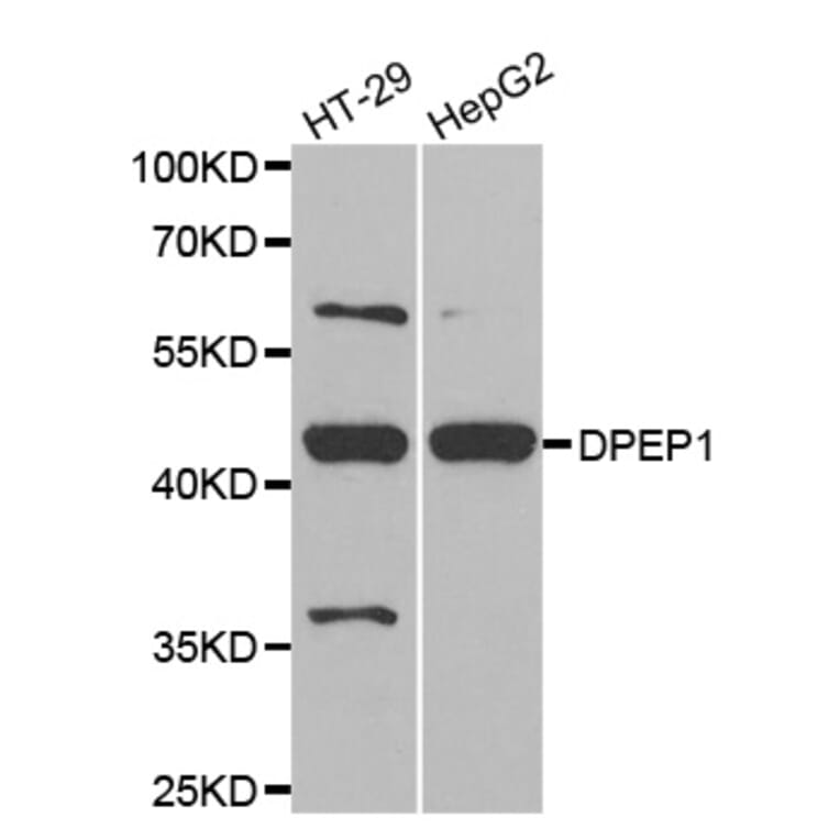 Western blot - DPEP1 antibody from Signalway Antibody (38797) - Antibodies.com