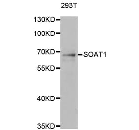 Western blot - SOAT1 antibody from Signalway Antibody (38815) - Antibodies.com