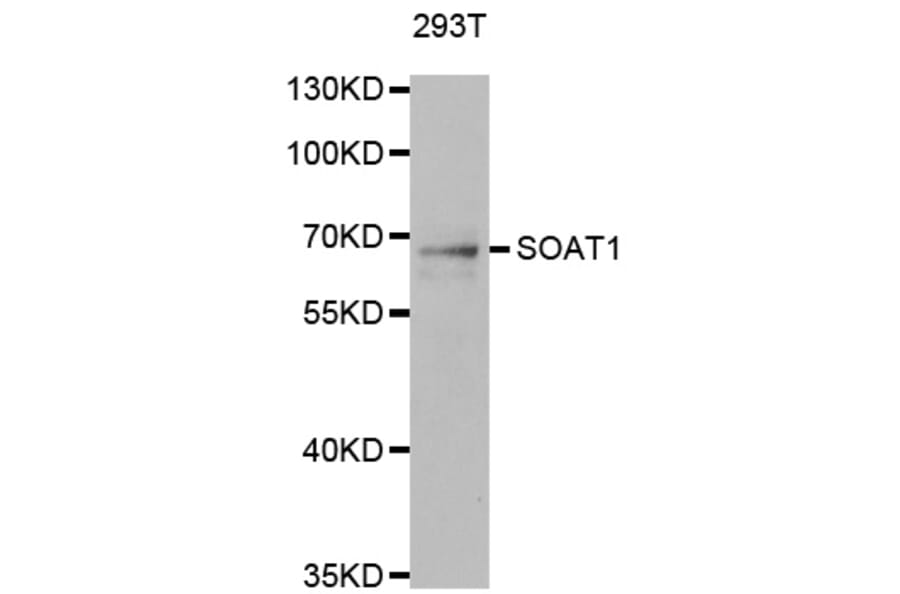Western blot - SOAT1 antibody from Signalway Antibody (38815) - Antibodies.com