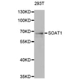 Western blot - SOAT1 antibody from Signalway Antibody (38815) - Antibodies.com