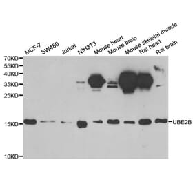 Western blot - UBE2B antibody from Signalway Antibody (38818) - Antibodies.com