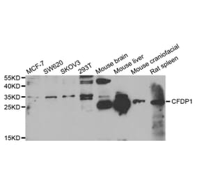 Western blot - CFDP1 antibody from Signalway Antibody (38826) - Antibodies.com