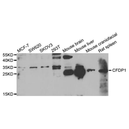 Western blot - CFDP1 antibody from Signalway Antibody (38826) - Antibodies.com