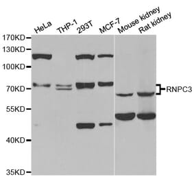 Western blot - RNPC3 antibody from Signalway Antibody (38832) - Antibodies.com