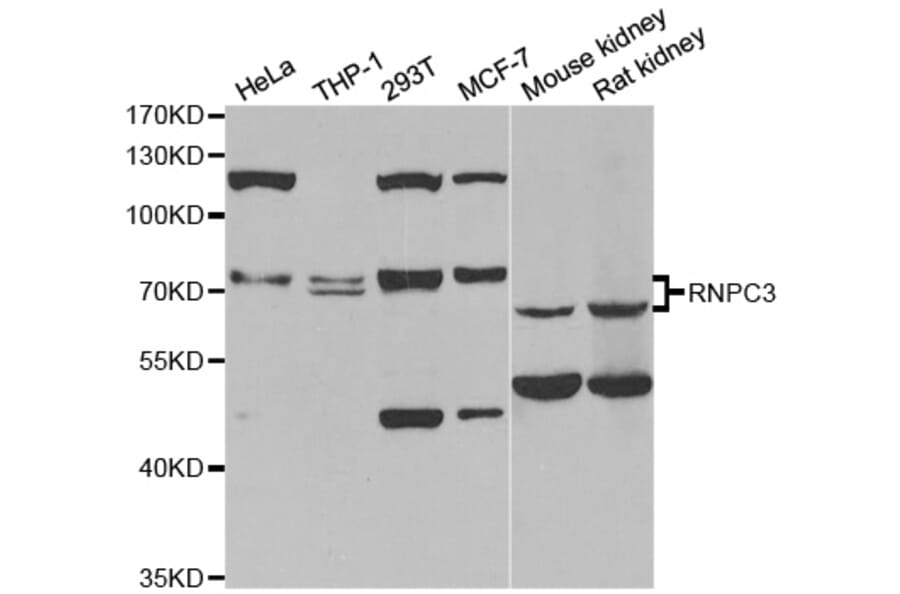 Western blot - RNPC3 antibody from Signalway Antibody (38832) - Antibodies.com