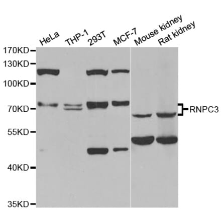 Western blot - RNPC3 antibody from Signalway Antibody (38832) - Antibodies.com