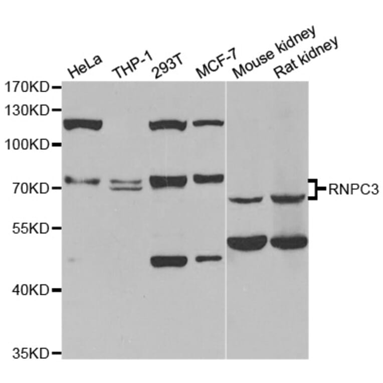 Western blot - RNPC3 antibody from Signalway Antibody (38832) - Antibodies.com