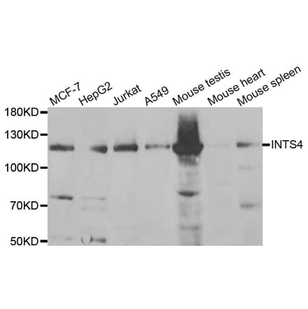 Western blot - INTS4 antibody from Signalway Antibody (38837) - Antibodies.com