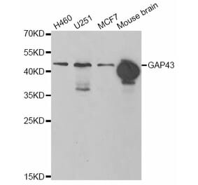 Western blot - GAP43 antibody from Signalway Antibody (38861) - Antibodies.com