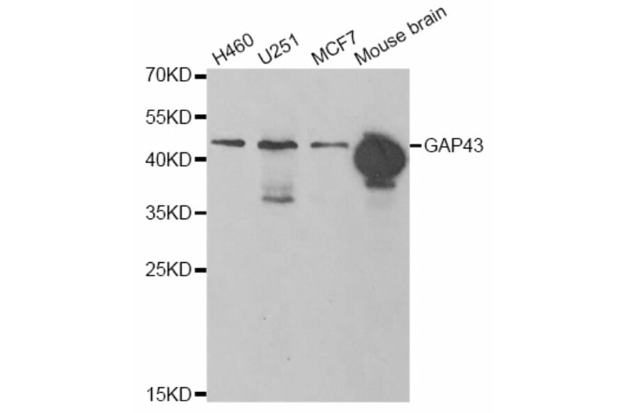Western blot - GAP43 antibody from Signalway Antibody (38861) - Antibodies.com