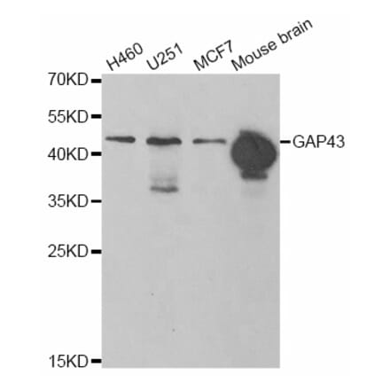 Western blot - GAP43 antibody from Signalway Antibody (38861) - Antibodies.com