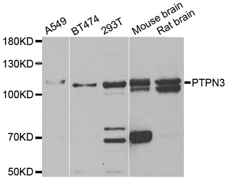 Western blot analysis of extracts of various cell lines, using PTPN3 antibody.