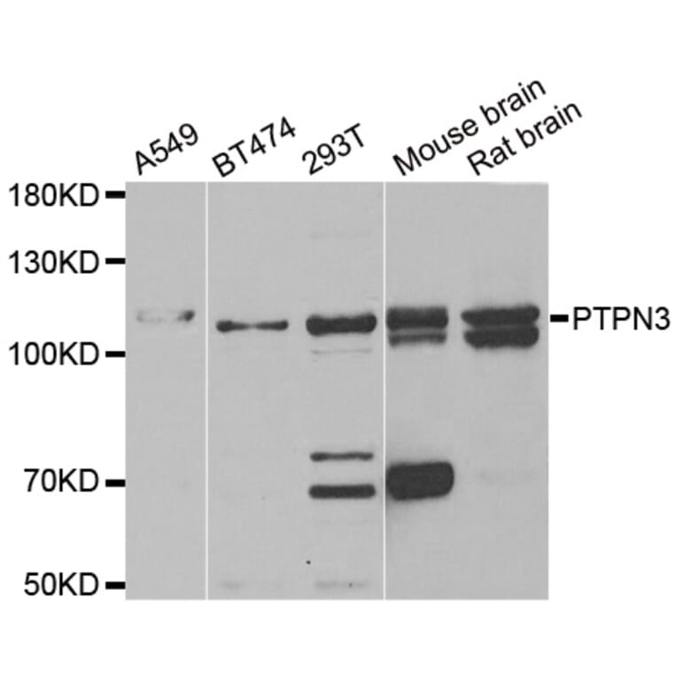 Western blot - PTPN3 antibody from Signalway Antibody (38880) - Antibodies.com