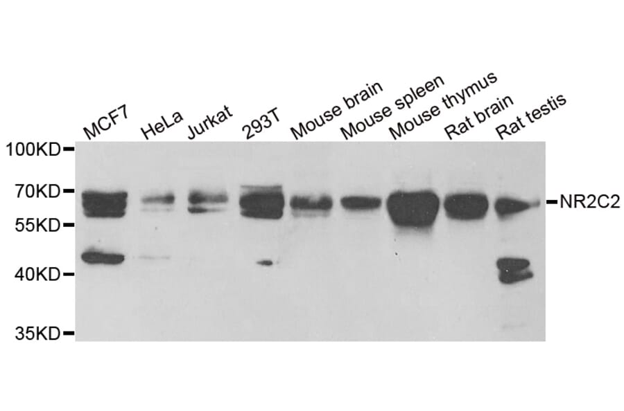 Western blot - NR2C2 antibody from Signalway Antibody (38900) - Antibodies.com