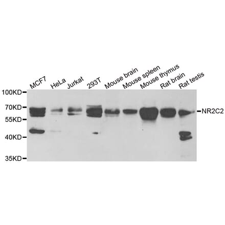 Western blot - NR2C2 antibody from Signalway Antibody (38900) - Antibodies.com