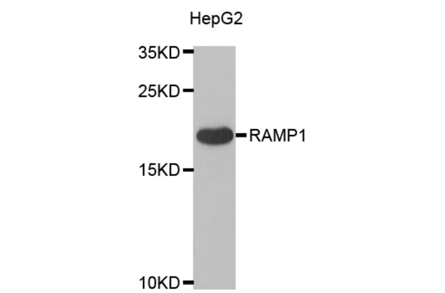 Western blot - RAMP1 antibody from Signalway Antibody (38925) - Antibodies.com