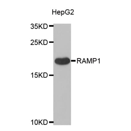 Western blot - RAMP1 antibody from Signalway Antibody (38925) - Antibodies.com