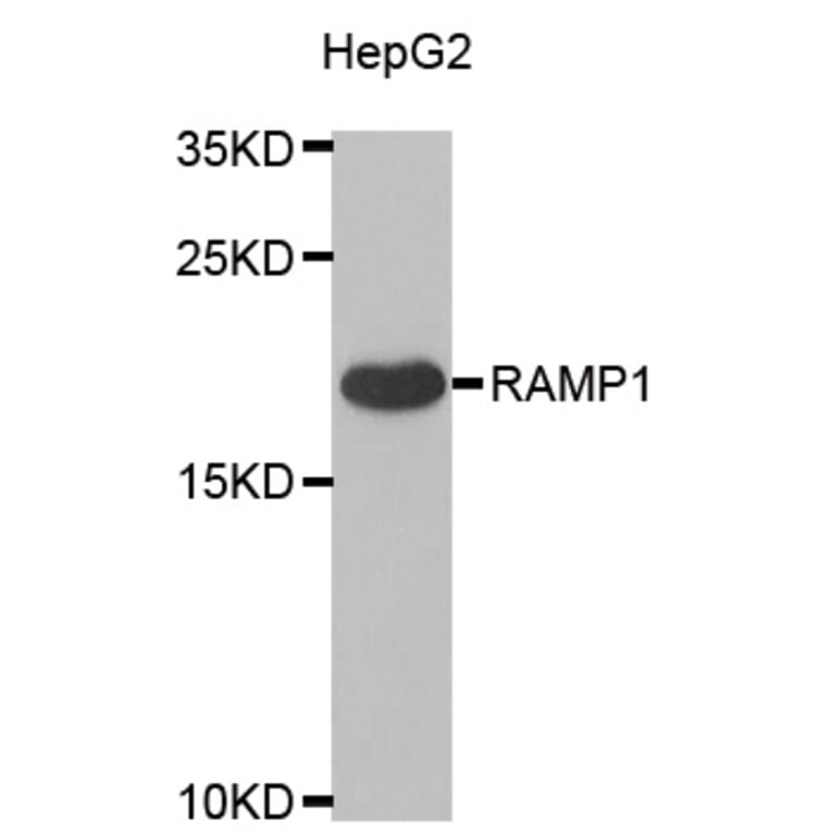 Western blot - RAMP1 antibody from Signalway Antibody (38925) - Antibodies.com