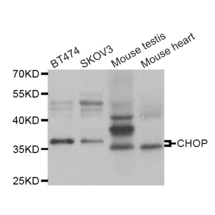 Western blot - DDIT3 antibody from Signalway Antibody (38967) - Antibodies.com