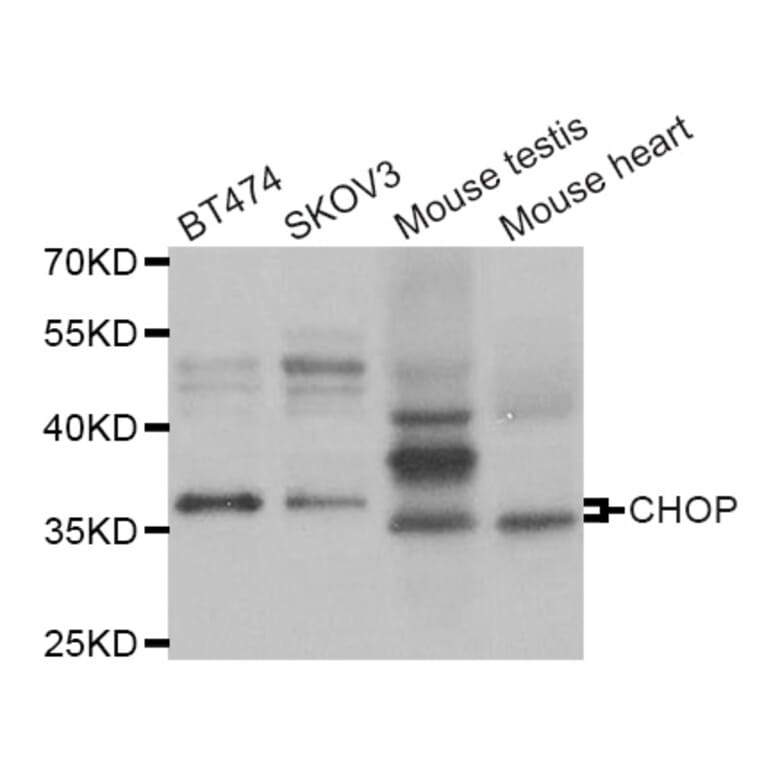 Western blot - DDIT3 antibody from Signalway Antibody (38967) - Antibodies.com