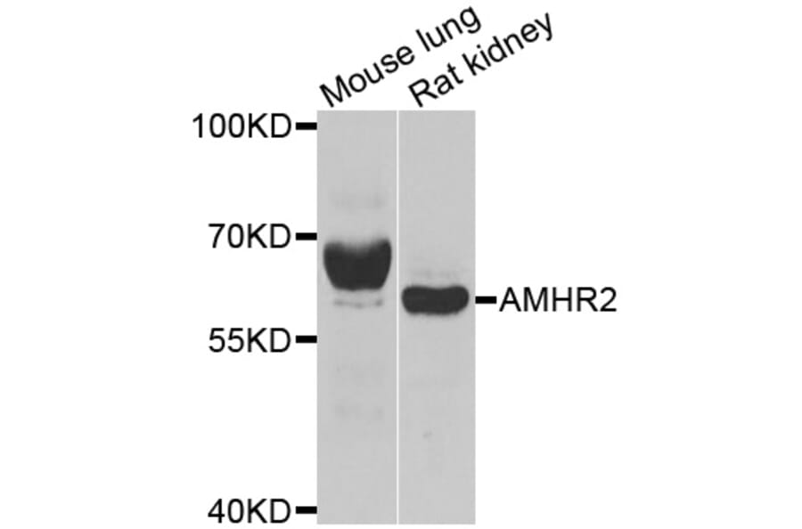 Western blot - AMHR2 antibody from Signalway Antibody (38977) - Antibodies.com