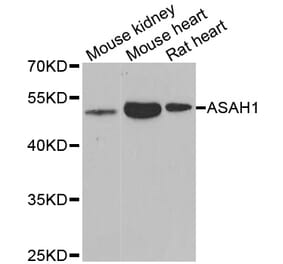 Western blot - ASAH1 antibody from Signalway Antibody (38980) - Antibodies.com