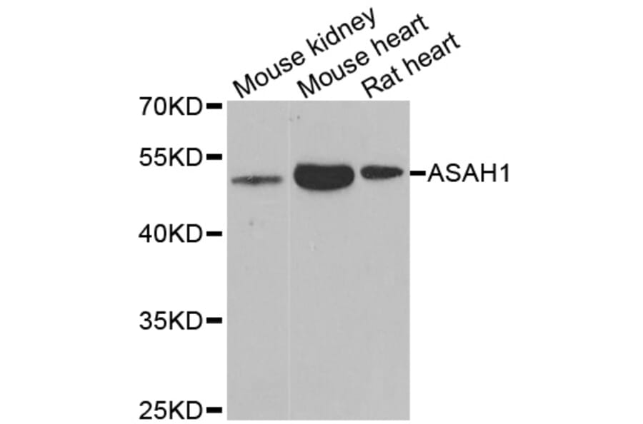 Western blot - ASAH1 antibody from Signalway Antibody (38980) - Antibodies.com