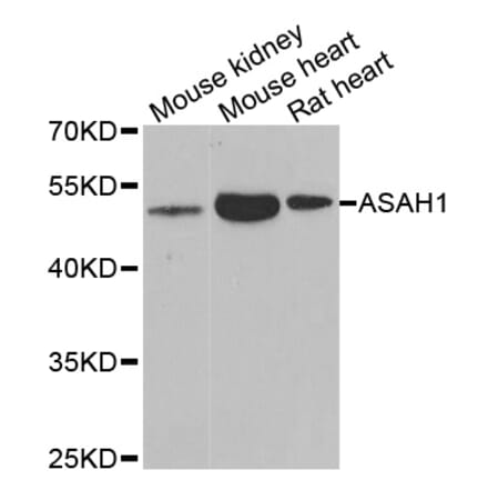 Western blot - ASAH1 antibody from Signalway Antibody (38980) - Antibodies.com