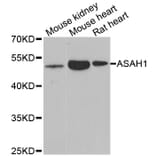 Western blot - ASAH1 antibody from Signalway Antibody (38980) - Antibodies.com