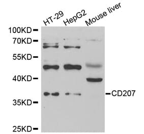 Western blot - CD207 antibody from Signalway Antibody (39003) - Antibodies.com