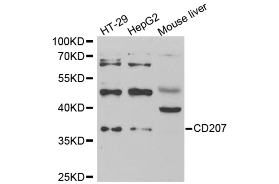Western blot - CD207 antibody from Signalway Antibody (39003) - Antibodies.com